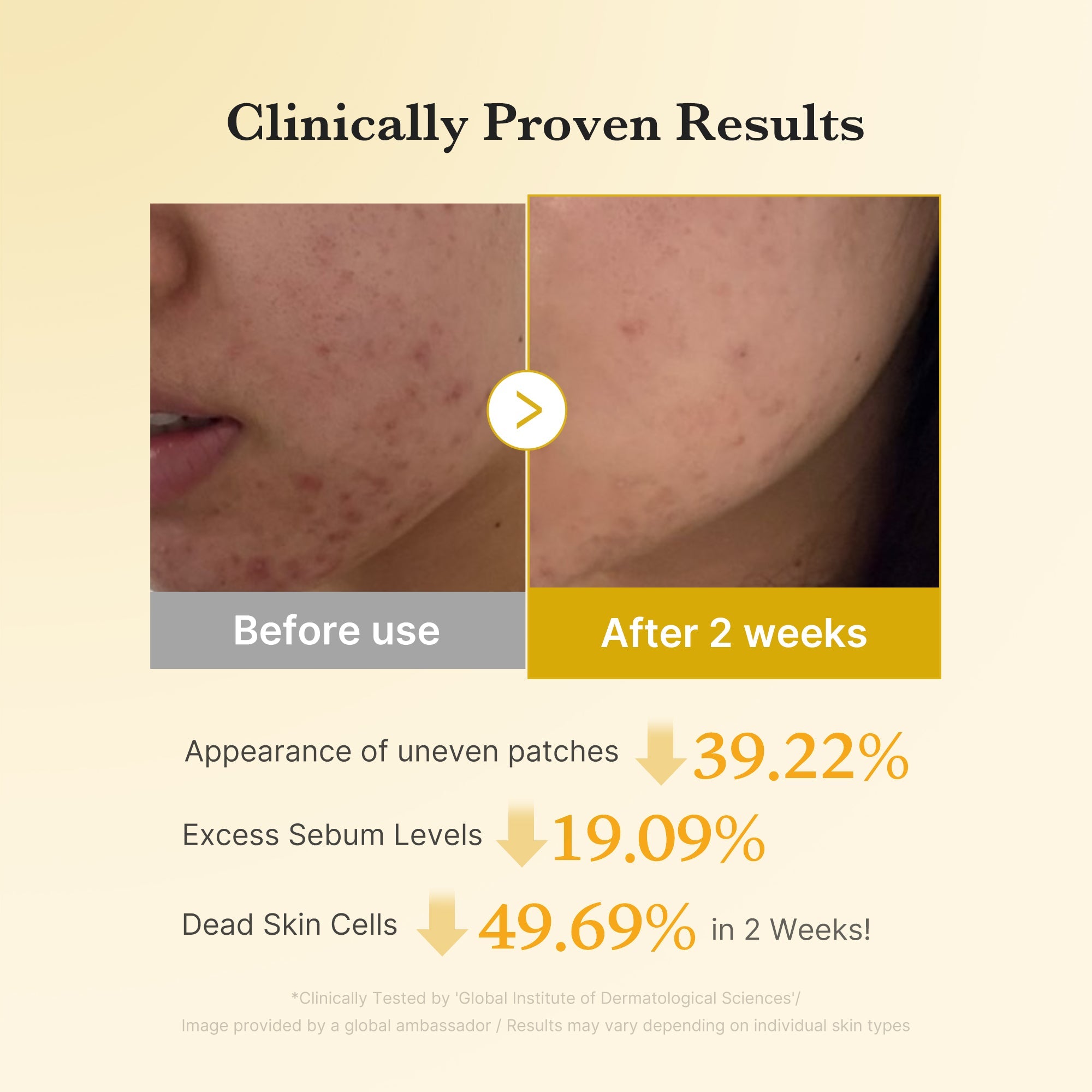 Medicube Kojic Acid Turmeric Pad 160ml ( 70Pads )