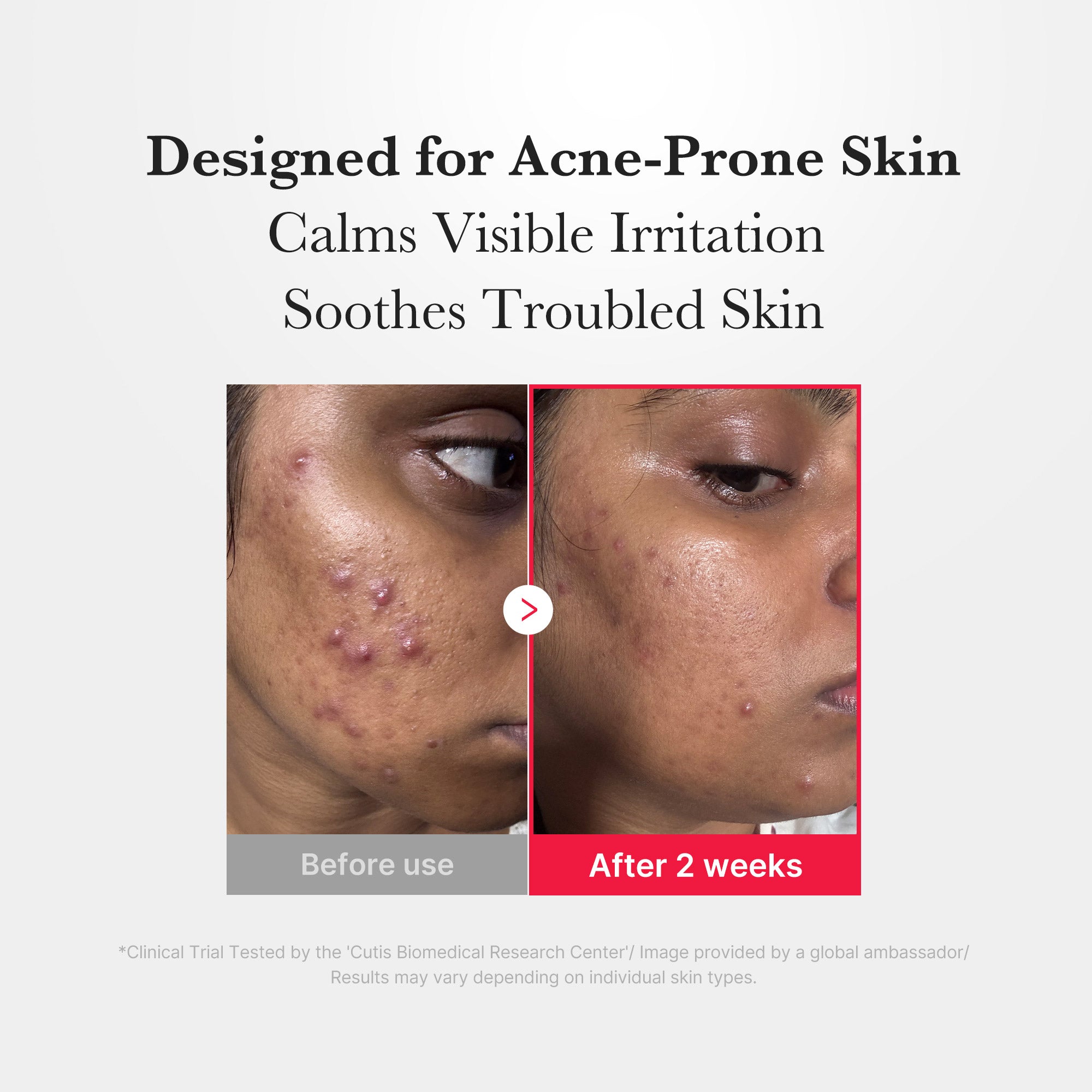 Medicube Hypochlorous Acid Daily Facial Spray 125ml