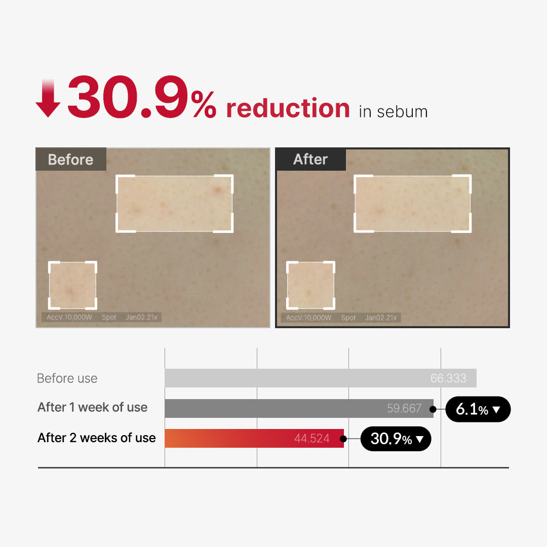 Medicube Red Acne Body Peeling Shot 110gm