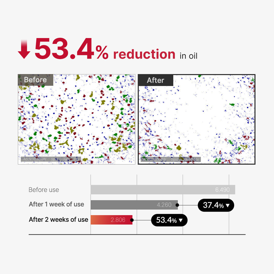 Medicube Red Acne Body Peeling Shot 110gm