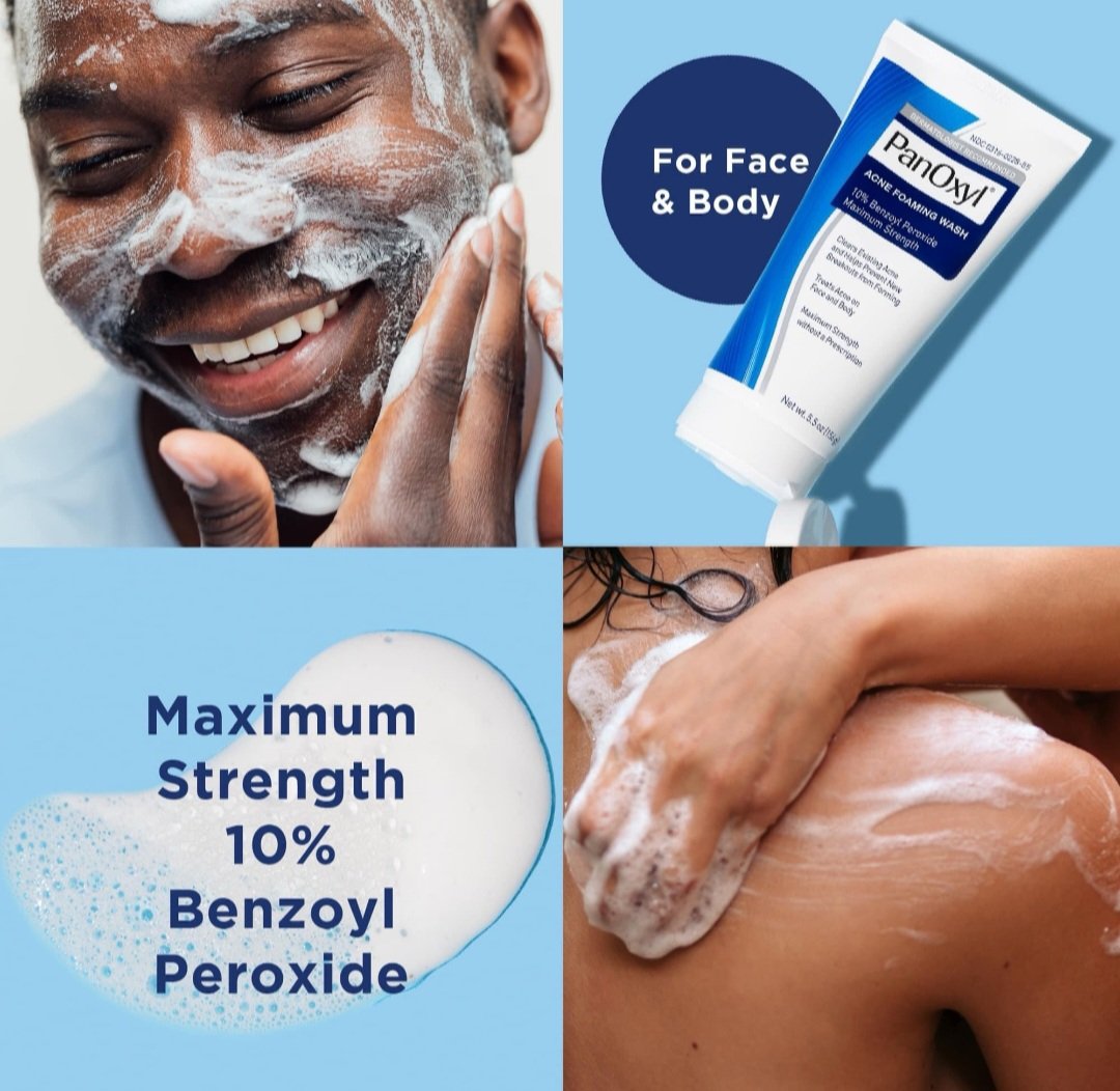 PanOxyl Acne Foaming Wash Benzoyl Peroxide 10% Maximum Strength.