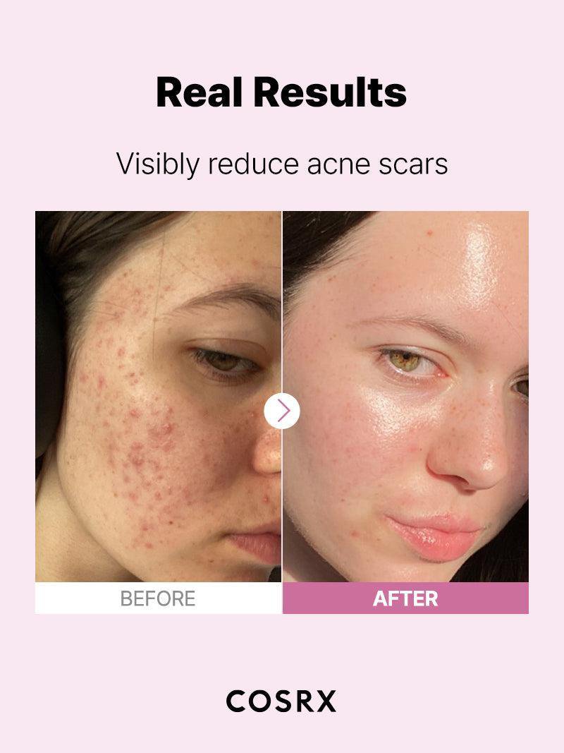 Cosrx The Niacinamide 15 [/Serum/]