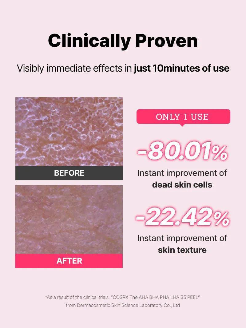 Cosrx The AHA BHA PHA LHA 35 Peel 30 ML