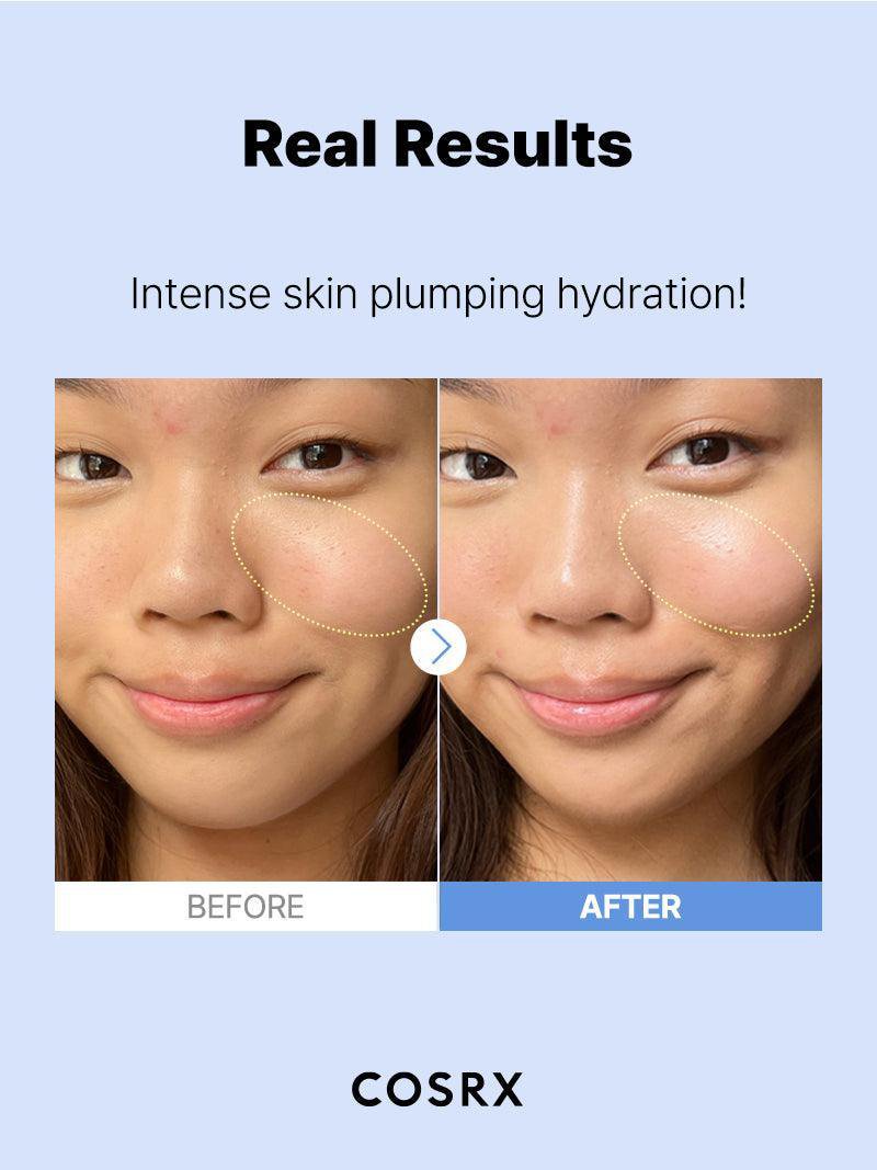 Cosrx The Hyaluronic Acid 3 [/Serum/]