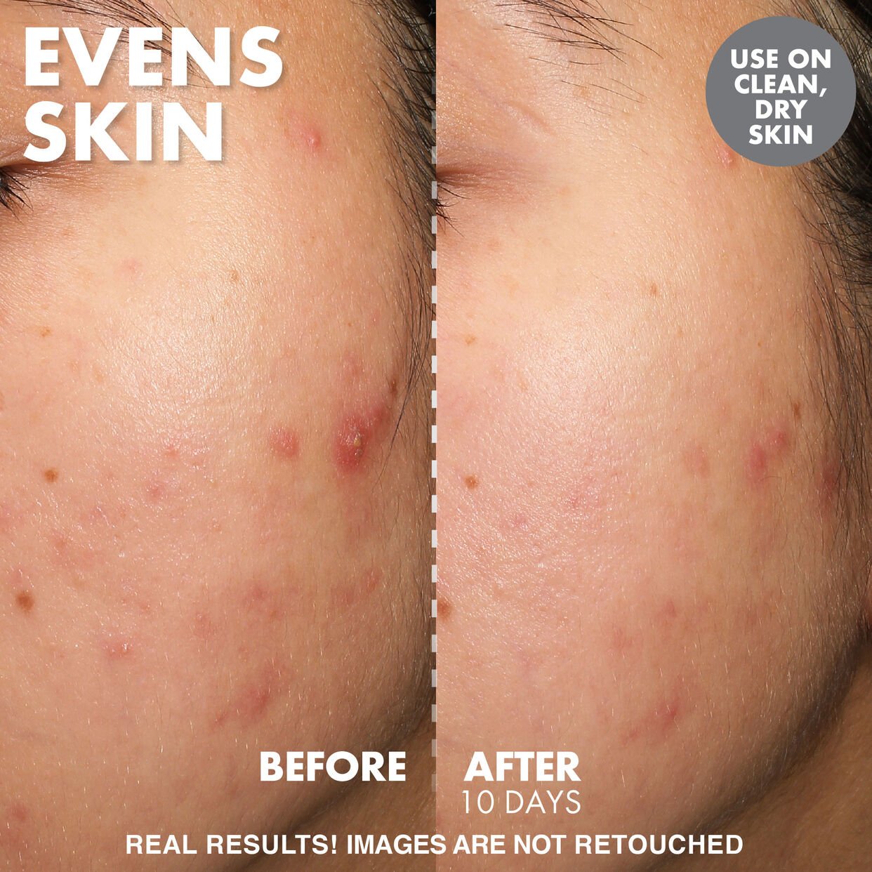 Wishful Mini Yo Glow AHA &amp; BHA Facial Enzyme Scrub 40 ML