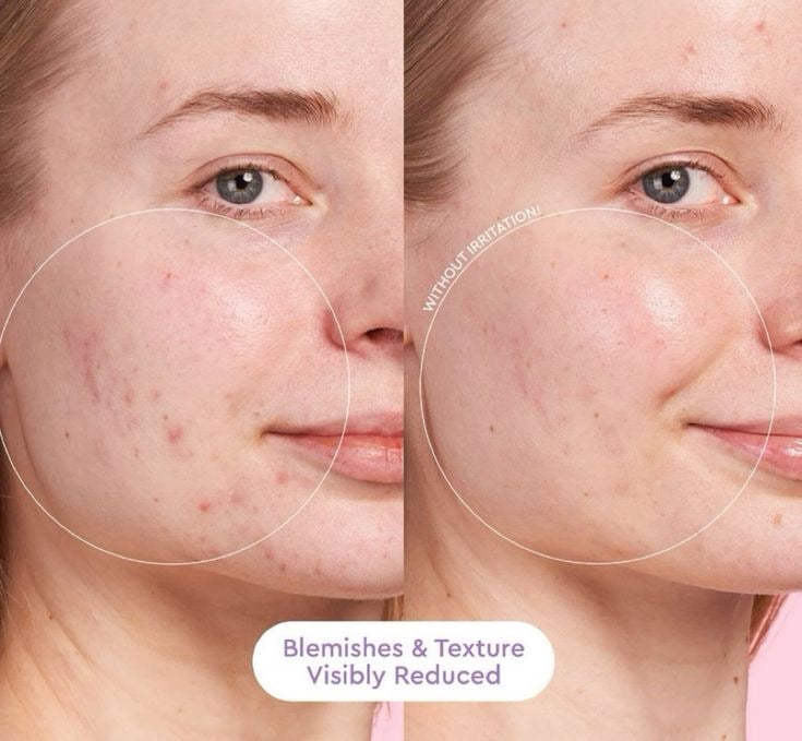 Glow recipe blackberry retinol blemish serum 30 ml