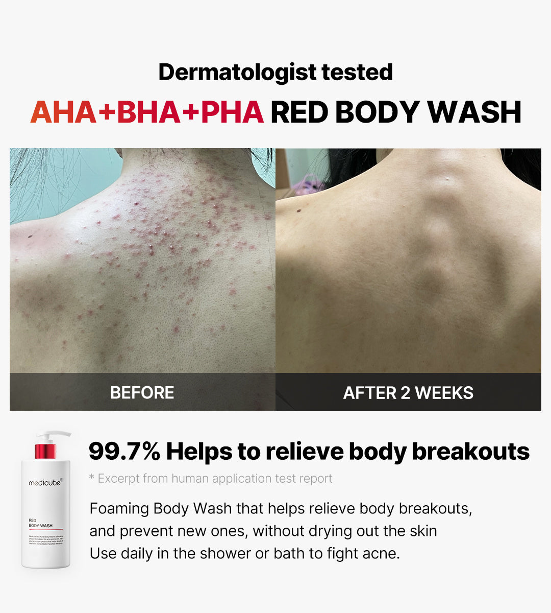 Medicube Red Body Wash AHA/BHA/PHA / Niacinamide  400 gm