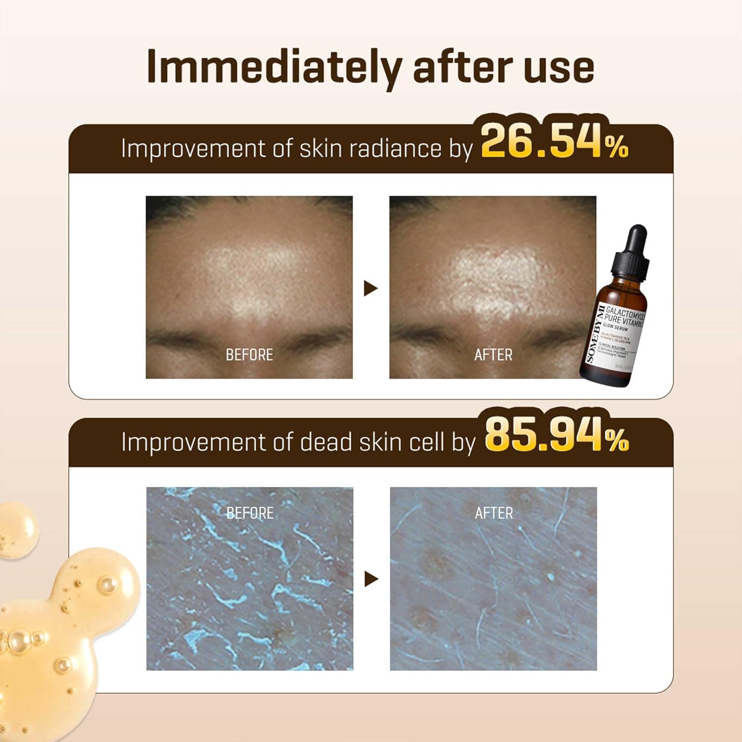 Some By Mi Galactomyces Pure Vitamin C Glow Serum 30 ml