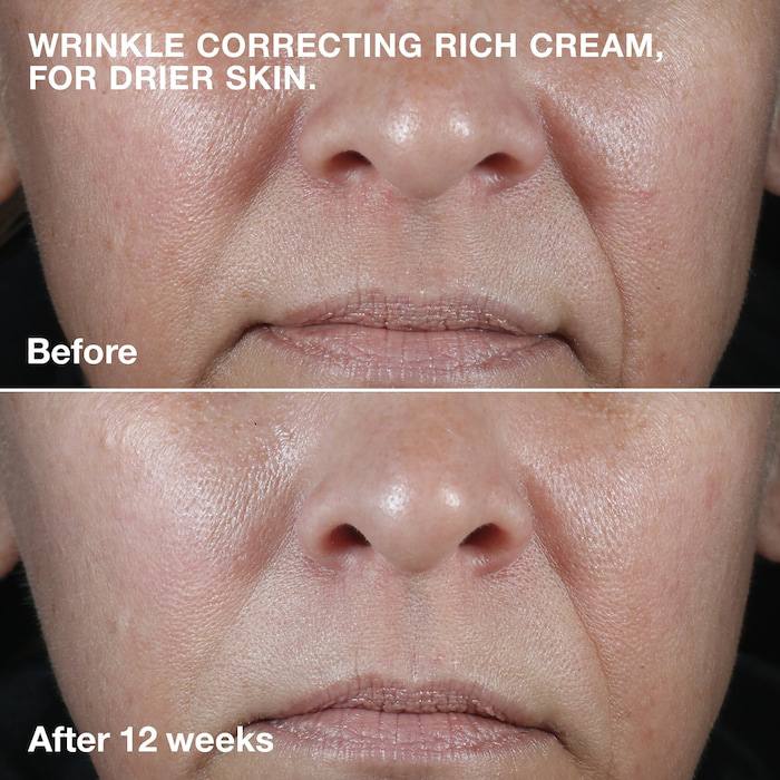 CLINIQUE Smart Clinical Repairª Wrinkle Correcting Cream