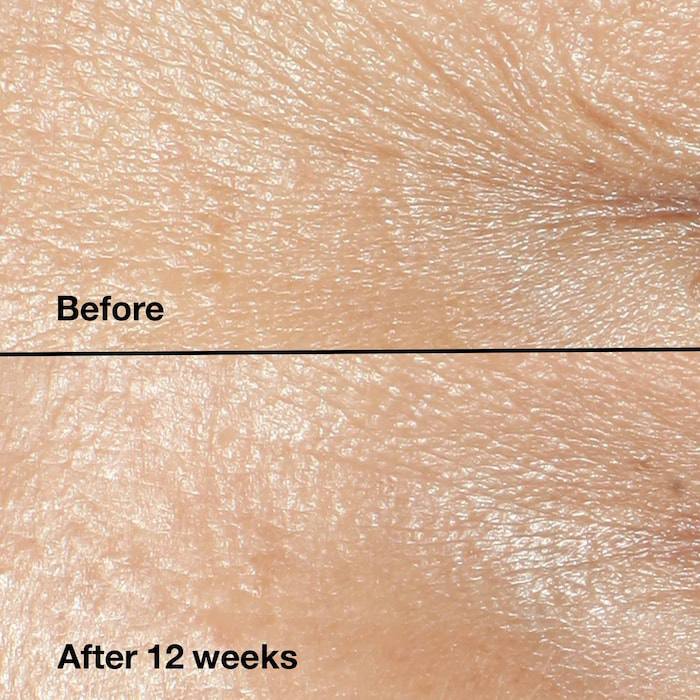 CLINIQUE Smart Clinical Repairª Wrinkle Correcting Cream