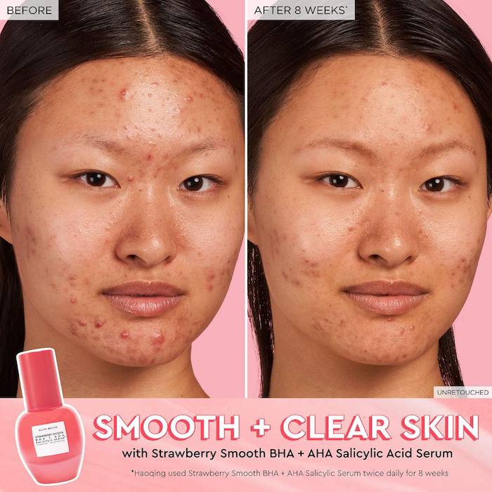 Glow Recipe Strawberry Smooth BHA + AHA Salicylic Acid Serum 30 ml